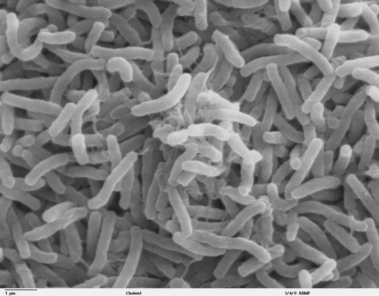 http://medmalay.com/wp-content/uploads/2020/11/Cholera_bacteria_SEM.jpg