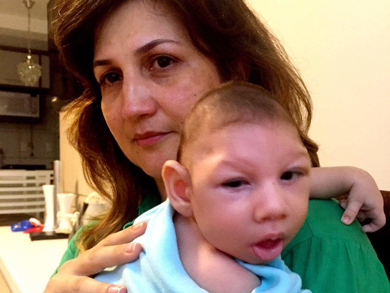 Marilla Lima, seorang ibu Brazil, menghidap virus Zika ketika hamil.  Anak lelakinya yang berusia 2.5 bulan, Arthur, mempunyai microcephaly - cacat lahir yang ditandai dengan kepala kecil dan kerosakan otak yang teruk. 