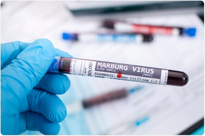 Virus Marburg