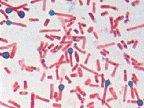 a.  Spora dan bakteria Clostridium tetani dengan bentuk tongkat khas yang diasingkan dari kerak luka dehorning pada kes 1 (gram-pewarnaan-1000x). 